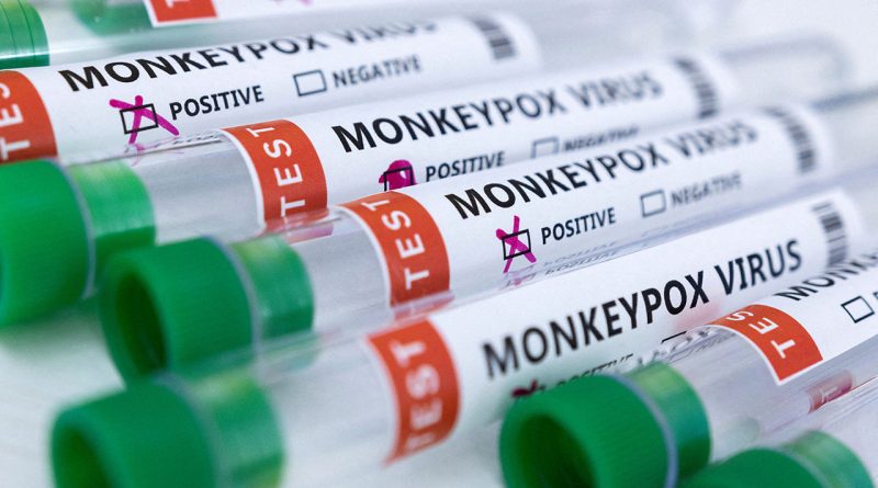 Public health emergency declared in San Diego over monkeypox