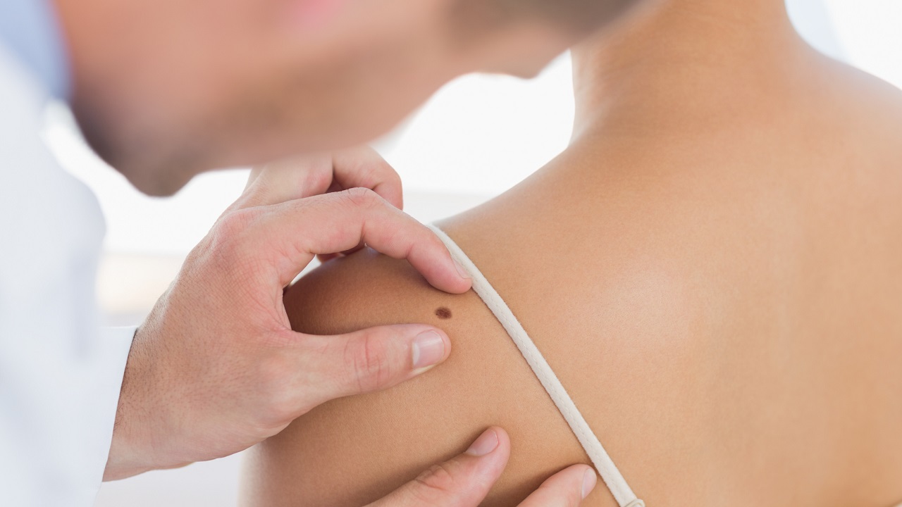 The Crucial Elements of Skin Cancer